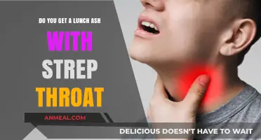 Understanding Strep Throat: Lunch Ash and Other Common Symptoms