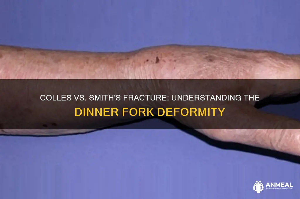 is colles or smith dinner fork