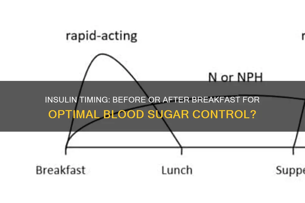 should insulin be given before or after breakfast