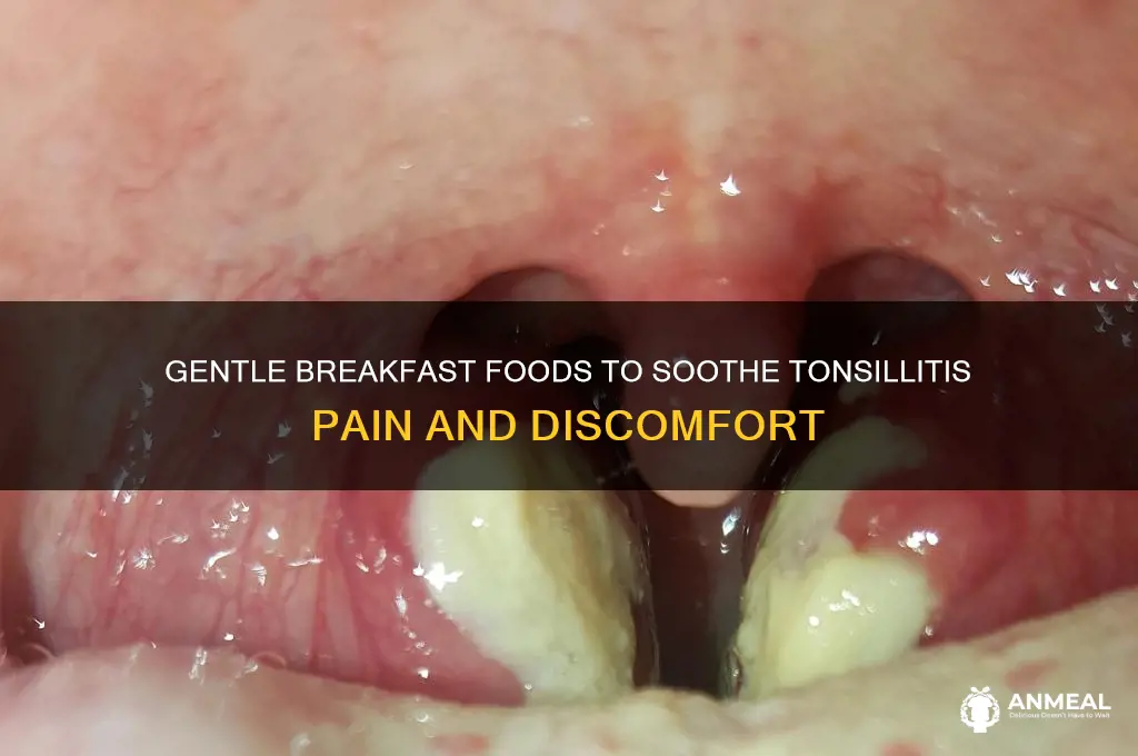what is really soft breakfast foods for tonsillitis