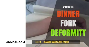 Understanding the Dinner Fork Deformity: Causes, Symptoms, and Treatment Options