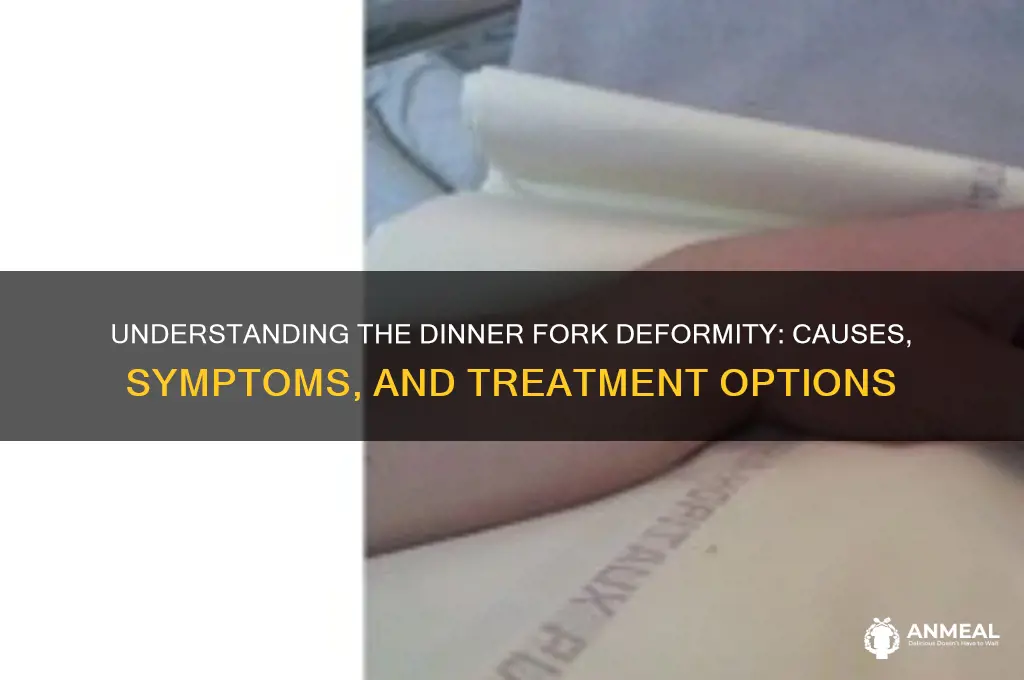 what is the dinner fork deformity